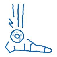 reumatoid artrit av fot klotter ikon hand dragen illustration vektor