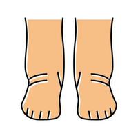 fötter ödem hälsa sjukdom färg ikon vektor illustration