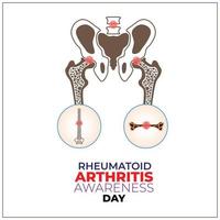 rheumatoide Arthritis Bewusstsein Tag. 2 Februar. Vorlage zum Hintergrund, Banner, Karte, Poster. Vektor Illustration.