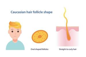 infographic av caucasian hår follikel form vektor illustration isolerat på vit bakgrund.