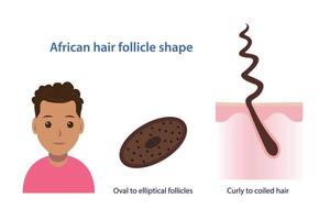 infographic av afrikansk hår follikel form vektor illustration isolerat på vit bakgrund.