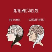 Alzheimer Krankheit Demenz Medizin Vektor Illustration