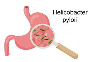Gastritis mit Helicobacter Pylori unter Vergrößerung Glas. Vektor Illustration, Karikatur Stil
