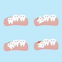 påverkade tand- eller visdomständer tand- och munsjukdomar vektor