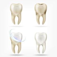 Vektorsatz des realistischen sauberen und schmutzigen Zahns 3d, der Zahnprozess löscht. Mundpflege, Zahnrestauration