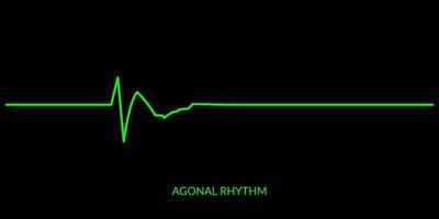 ecg hjärtslag linje. elektrokardiogram vektor illustration. agonal rytm