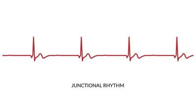 ecg hjärtslag linje. elektrokardiogram vektor illustration. kopplingspunkt rytm