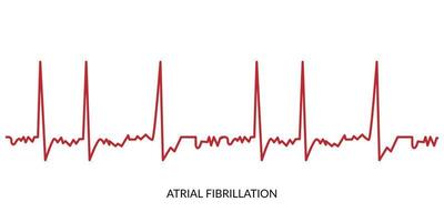 EKG Herzschlag Linie. Elektrokardiogramm Vektor Illustration. atrial Flimmern