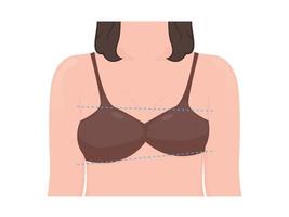 asymmetrisk kvinna bröst vektor illustration