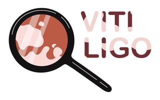 Vitiligo schließen oben Aussicht von Haut Vektor Illustration