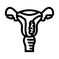 Endometrium Krebs Linie Symbol Vektor Illustration