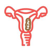 Endometrium Krebs Farbe Symbol Vektor Illustration