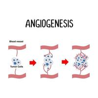 angiogenes de bildning av ny blod fartyg vektor