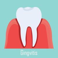 tandköttsinflammation, gummi sjukdom isolerat illustration kommer tand. dental vård, stomatologi problem begrepp. vektor