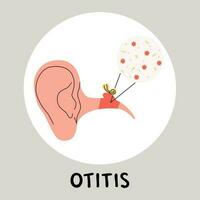 Otitis Medien eben Vektor medizinisch Illustration. Ohrenschmerzen weil von Infektion im das Mitte Ohr. entzündlich Krankheiten.