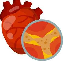 Cholesterin im Vene und Arterien. Herz und Organ Krankheit. Blockierung und Behinderung von Kanal. vergrößert Aussicht unter Mikroskop. Gesundheit Problem. eben medizinisch Bildung vektor