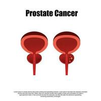 prostatit vanligt och inflammerad prostata isolerat vektor