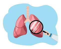 illustration av en läkare granskning de lungor använder sig av en förstorande glas. lunga undersökning vektor