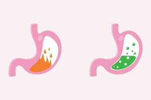 Illustration von Pyrose Bauch und Übelkeit Magen. Pyrose Feuer Störung, Magen- Acid Rückfluss. Bauch medizinisch Illustration einstellen vektor