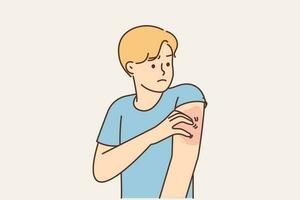ohälsosam man kliar sig ärm lida från apa pox. sjuk kille klia hand kamp med dermatologi problem. sjukvård. vektor illustration.
