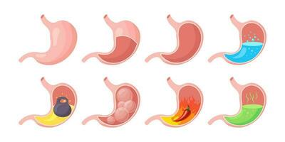 gesund und ungesund, leeren und voll Mensch Magen, Symbole Satz. Ernährung, Bauch Schmerz, Sodbrennen, Schwere, Blähungen. Anatomie von das Verdauungs- System. Vektor