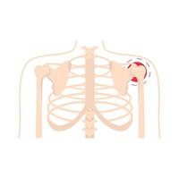 Rheuma Schulterschmerzen vektor