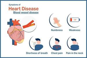 medizinisch Illustration Vektor Konzept, Symptome von Herz Krankheit verursacht durch Arteriosklerose, Taubheitsgefühl, Brust Schmerz, Schwäche, Kürze von Atem und Hals Schmerz.flach Stil