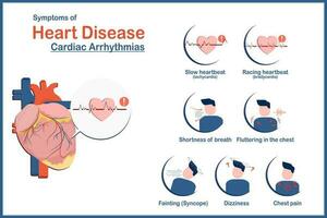 medizinisch Illustration Konzept, Herz Krankheit Symptome verursacht durch irregulär Herzschlag oder Herz Arrhythmien, Ermüdung, Tachykardie, Bradykardie, Schwindel, Truhe Schmerzen und Synkope, eben Stil vektor