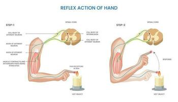 Hand Reflex Aktion, unfreiwillig, schnell Antwort zu sensorisch Stimulus zum Schutz oder Koordinierung vektor