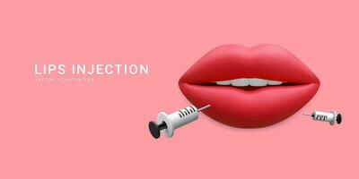 3d realistisk baner för läpp injektion. begrepp av dermatologi och kosmetologi behandling. röd estetisk skön mun med medicinsk plast spruta med kosmetisk injektion i tecknad serie stil vektor