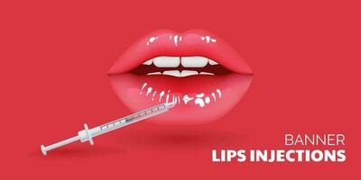 3d Illustration von realistisch Lippen unterziehen ein kosmetisch Verfahren zum Altern Pflege. Schönheit Klinik Konzept Vitrinen das Korrektur und Konturierung von Lippen mit Füllstoffe Injektionen. Ideal zum Gesundheit Pflege vektor