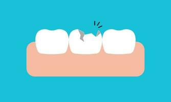 gebrochen Weiß Zähne und Zahnfleisch Illustration Vektor Design auf Blau Hintergrund. Dental Pflege Konzept.