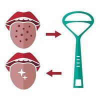 Vektor Illustration von Zunge Hygiene. Zunge Reiniger, schmutzig und sauber Zunge isoliert im Weiß. Dental Pflege. Oral Hygiene und Dental Verfahren Konzept. eben Stil