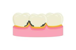 Dental Plakette Vektor Illustration. Zahnschmerzen Symbol Zeichen Symbol