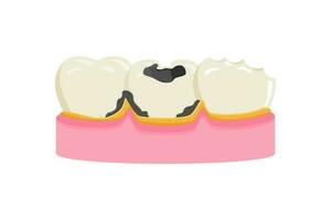 Hohlraum Zähne Vektor Illustration. Zahnschmerzen Symbol Zeichen Symbol