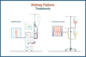 medicinsk illustration behandling av njure fel. hemodialys och peritoneal dialysis.vector illustrationer platt stil.hälsa vård och medicinsk begrepp. vektor