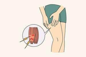 Nahansicht von Sportler strecken Bein Muskel leiden bilden Schmerz. nicht wohl Person haben Verletzung oder Krampf von Sport Aktivität. Athlet Trauma und zuerst Hilfe Konzept. Vektor Illustration.