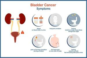 medizinisch Vektor Illustration Infografik Blase Krebs, Blase Krebs Symptome im eben Stil.Vektor Illustration von Mensch Blase mit Krebs auf Weiß Hintergrund.