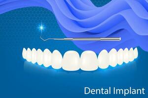 Mensch Zähne und Dental implantieren Vektor Illustration.