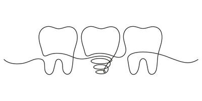 tänder rad med friska och implantera tand, kontinuerlig konst linje teckning. tandvård hälsa. vektor hand dragen illustration