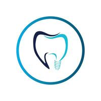 Dental implantieren Logo vektor