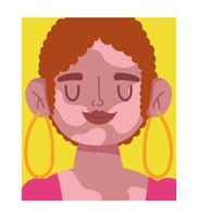 perfekt unvollkommenes Gesicht einer Cartoon-Frau mit Vitiligo vektor