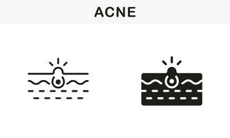 djup smutsig por, hud problem symbol samling. hud acne, pormask, comedo linje och silhuett svart ikon uppsättning. finne och inflammation talg piktogram. isolerat vektor illustration.