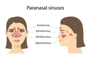 paranasal bihålor. frontal, etmoidal, sphenoidal, och maxillary bihålor. främre och lateral se. isolerat vektor illustration på en vit bakgrund