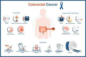 Vektor Infografik Illustration von Doppelpunkt Krebs. medizinisch Illustration Konzept. Doppelpunkt Krebs Symptome, Ursachen und Risiko Faktoren und Diagnose von Darm cancer.flat Stil isoliert auf Weiß Hintergrund.