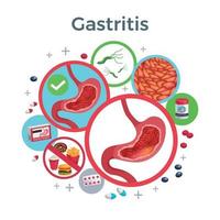 gastritis flache zusammensetzungsvektorillustration vektor