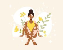 schön schwarz Frau mit Vitiligo auf Blumen- Hintergrund. Vektor Charakter im eben Karikatur Stil. selbst Liebe und Körper positiv Konzept. Welt Vitiligo Tag Poster oder Banner