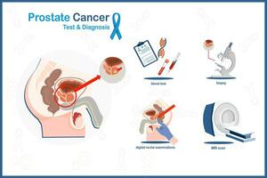 medicinsk vektor illustration i platt stil av prostata cancer i prostata cancer analys och diagnos koncept.blod test, biopsi, mri skanning, digital rektal undersökning.isolerad på vit bakgrund.