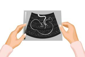 fotografieren von ein Ultraschall von ein ungeboren Babys Embryo im das Mutter Hände. Illustration, Vektor