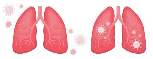 mänskliga lungor infekterade och friska coronavirus covid vektor
